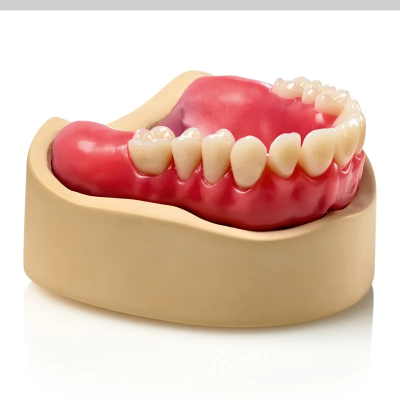 Zhermack Elite LC صينية علاج ضوء الأسنان نموذج المواد صينية مختبر الفردية قالب مخصص صينية المواد قاعدة الراتنج #2