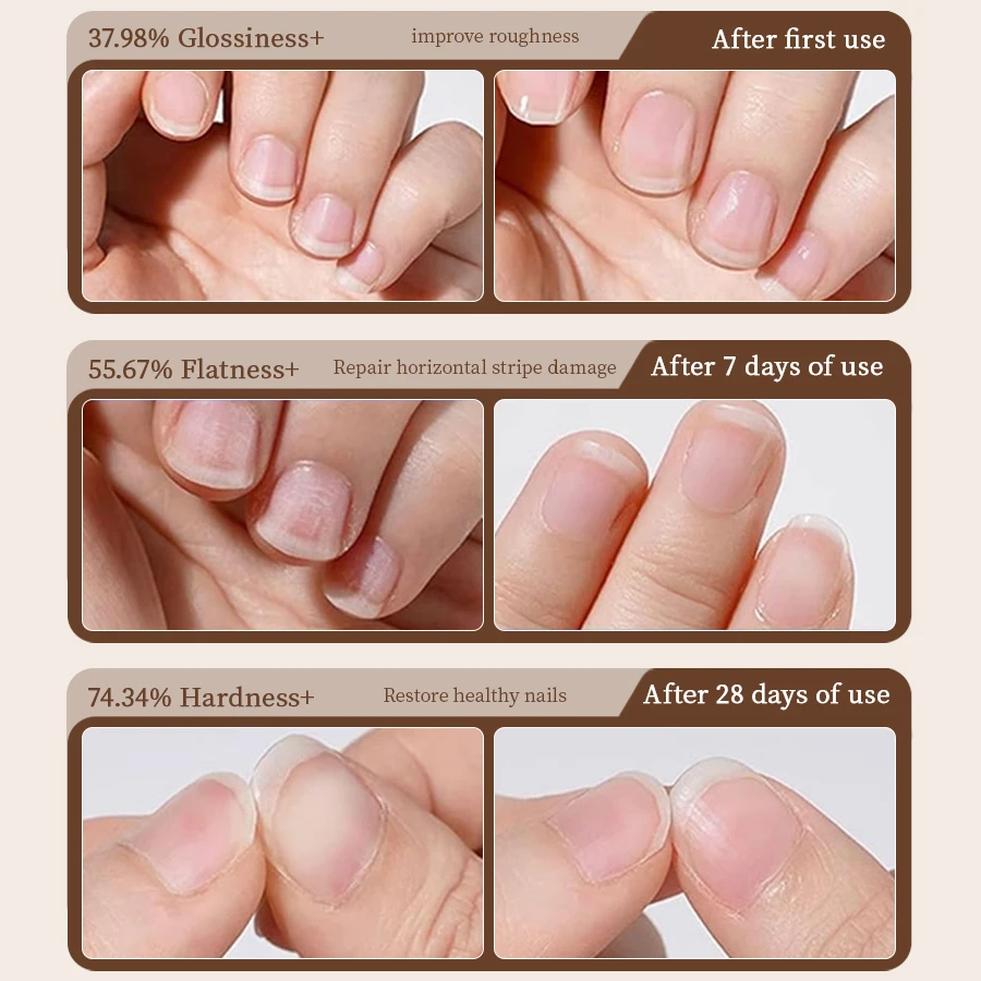 قلم زيت البشرة 3 في 1 من RSNAIL مع أداة دفع أظافر سيراميك للأظافر الجافة والتالفة - قلم العناية بالأظافر للإصلاح والتغذية