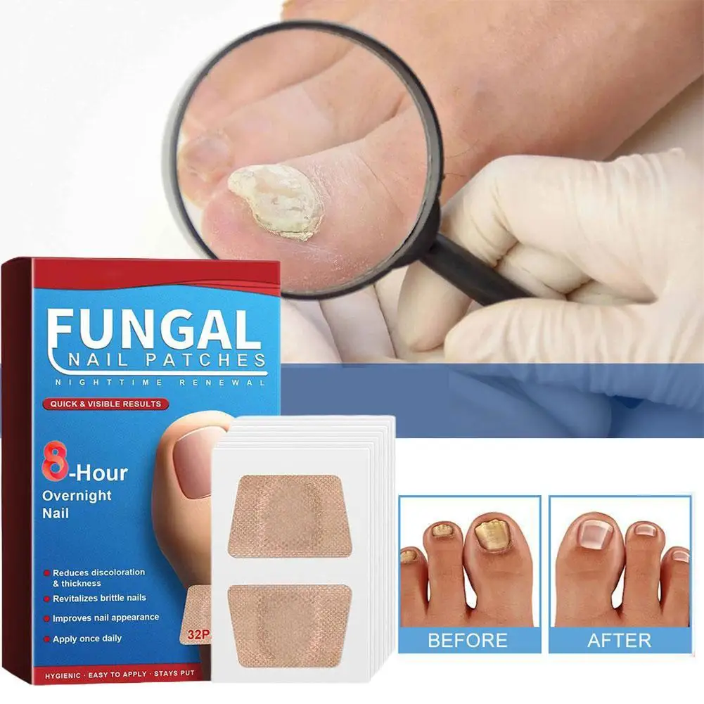 

Foot Nail Repair Patch Grey Fungal Nail Thicken Soft Paronychia Infection Hand Nail Correction Sticker Ingrown Toenail
