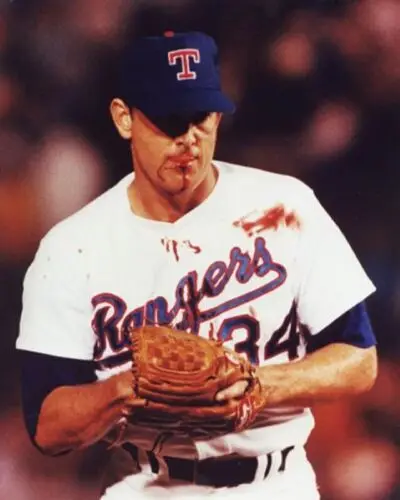 16 x 20 Poster Nolan Ryan Bloody Face