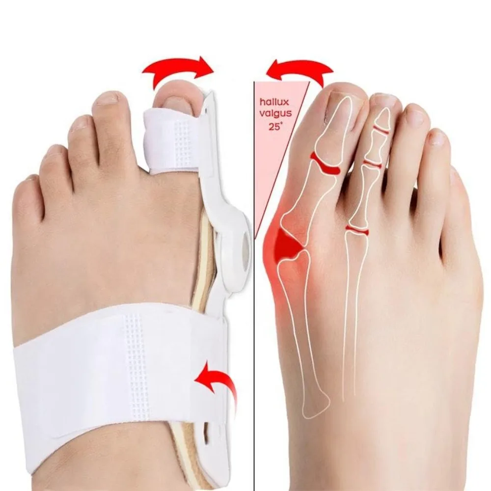 1Pc Bunion Corrector, Hallux Valgus Relief Pads Toe Spacer Straightener Big Toe Separator Correction Splint Foot Care Tool