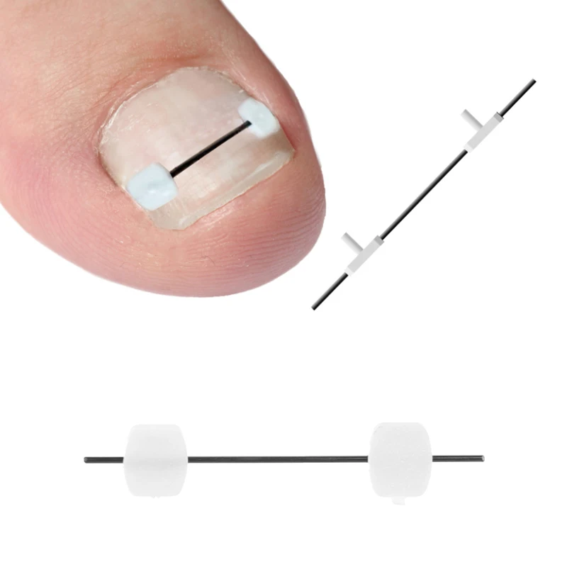 Corretor de unha encravada, fio de correção, ferramenta profissional, fio reutilizável, ferramenta de cuidados com os pés, liga de titânio, fio de titânio