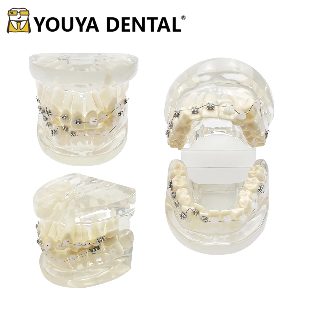 Orthodontic Teaching Teeth Model For Dentist Student Practice Model Demonstrate Doctor-patient Communication Tools