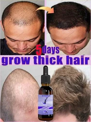 Fast Hair Growth Essence Effective Anti Hair Loss Serum Baldness Repair Hereditary Postpartum Seborrheic Hair Loss   Care