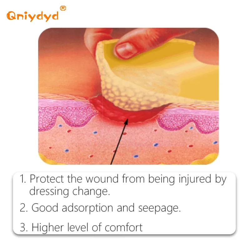 Alginate Wound Hydrocolloid Dressing Polyurethane Foam Dressing Highly Absorbent Medical Sterile Wound Ulcer Healing Patch