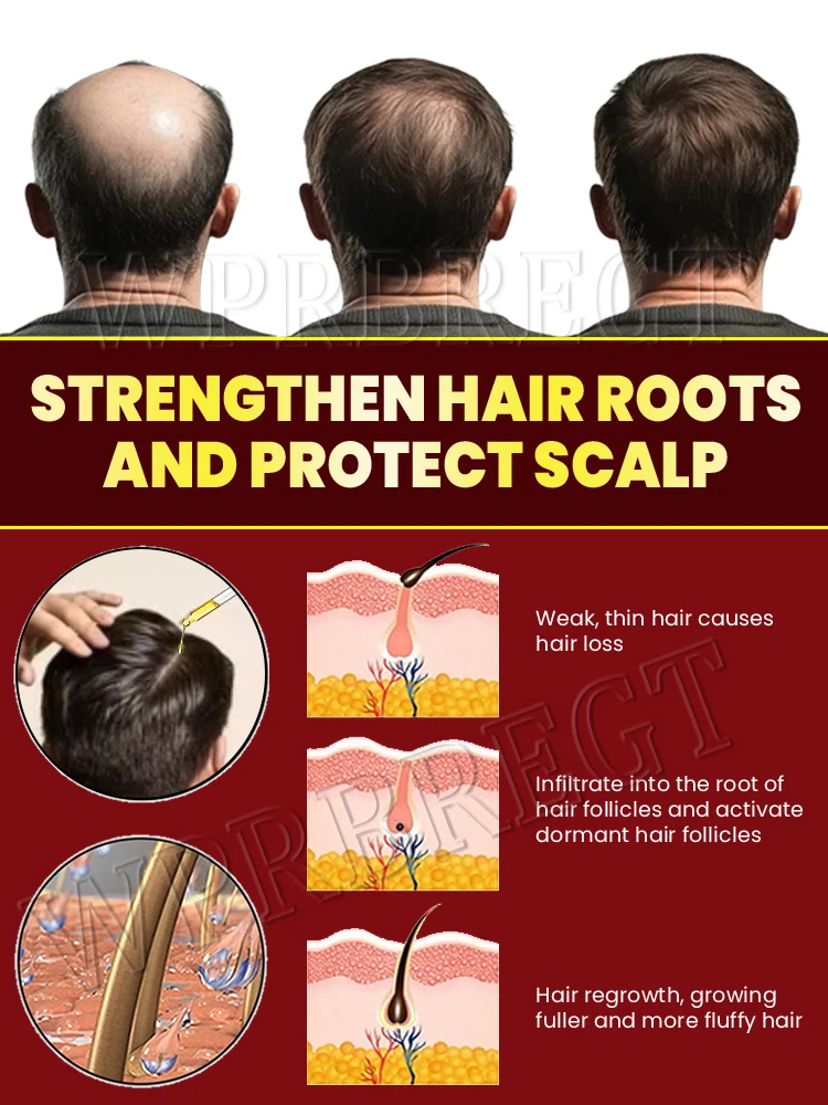 ̊خلبيش ذاكرة نمو، لحية الوجه، ذاثرى أوب سينوب من ذاقيد، تشيشت، أرمش، جميع شعر البابين، جميع شيميازابل #4