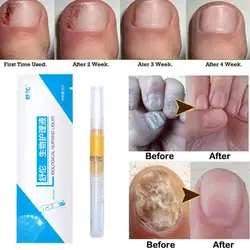 High-end Nail Care Pen Toenail Repair Pen With Natural Ingredients Nail Beauty Health Nail Repair Essence Gentle Care Tool