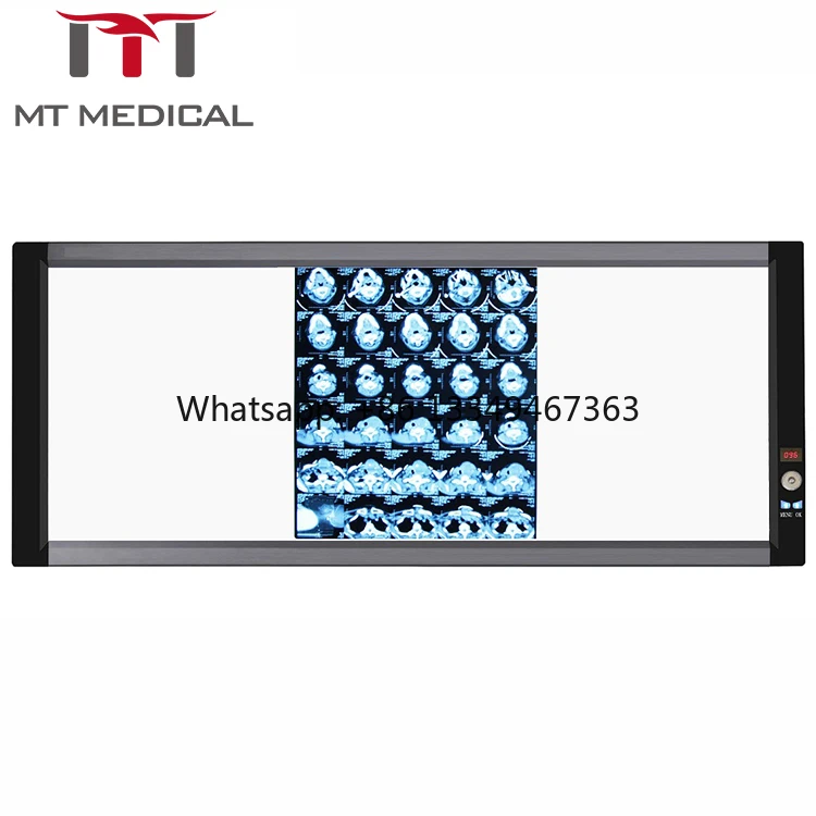 ΠΠ΅Π΄ΠΈΡΠΈΠ½ΡΠΊΠΈΠΉ Π²ΠΈΠ΄ Π‘ΡΠΎΠΌΠ°ΡΠΎΠ»ΠΎΠ³ΠΈΡΠ΅ΡΠΊΠ°Ρ ΡΡΠΎΠΉΠ½Π°Ρ ΠΏΠ°Π½Π΅Π»Ρ Π‘Π²Π΅ΡΠΎΠ΄ΠΈΠΎΠ΄Π½Π°Ρ ΡΠ΅Π½ΡΠ³Π΅Π½ΠΎΠ²ΡΠΊΠ°Ρ ΠΏΠ»Π΅Π½ΠΊΠ° ΠΠ΅Π΄ΠΈΡΠΈΠ½ΡΠΊΠΈΠΉ Π‘ΠΎΡΠ· ΠΠΎΠ»ΡΠ½ΠΈΡΠ½ΡΠΉ ΡΠΊΠ°Π½Π΅Ρ ΠΠΎΡΠΎΠ±ΠΊΠ° Negatoscope Π Π΅Π½ΡΠ³Π΅Π½ΠΎΠ²ΡΠΊΠΈΠΉ ΠΏΡΠΎΡΠΌΠΎΡΡΡΠΈΠΊ ΠΏΠ»Π΅Π½ΠΊΠΈ Π±ΡΡΡΡΠ°Ρ Π΄ΠΎΡΡΠ°Π²ΠΊΠ° ΠΠ΅Π΄ΠΈΡΠΈΠ½ΡΠΊΠΈΠΉ Π²ΠΈΠ΄ Π‘ΡΠΎΠΌΠ°ΡΠΎΠ»ΠΎΠ³ΠΈΡΠ΅ΡΠΊΠ°Ρ ΡΡΠΎΠΉΠ½Π°Ρ ΠΏΠ°Π½Π΅Π»Ρ Π‘Π²Π΅ΡΠΎΠ΄ΠΈΠΎΠ΄Π½Π°Ρ ΡΠ΅Π½ΡΠ³Π΅Π½ΠΎΠ²ΡΠΊΠ°Ρ ΠΏΠ»Π΅Π½ΠΊΠ° ΠΠ΅Π΄ΠΈΡΠΈΠ½ΡΠΊΠΈΠΉ Π‘ΠΎΡΠ· ΠΠΎΠ»ΡΠ½ΠΈΡΠ½ΡΠΉ ΡΠΊΠ°Π½Π΅Ρ ΠΠΎΡΠΎΠ±ΠΊΠ° Negatoscope Π Π΅Π½ΡΠ³Π΅Π½ΠΎΠ²ΡΠΊΠΈΠΉ ΠΏΡΠΎΡΠΌΠΎΡΡΡΠΈΠΊ ΠΏΠ»Π΅Π½ΠΊΠΈ Π±ΡΡΡΡΠ°Ρ Π΄ΠΎΡΡΠ°Π²ΠΊΠ°