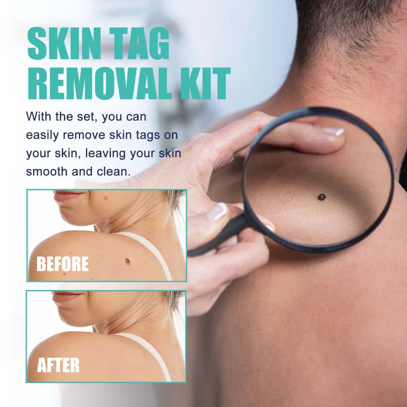 

Отшелушивающая сыворотка с увлажняющим уходом. Улучшает удаляет омертвевшую кожу клетка, увлажняет глубоко и восстанавливает барьер кожи.