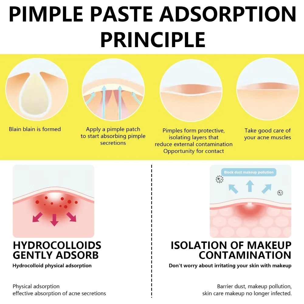 إزالة حب الشباب الغروانية المائية الكبيرة بقع بثرة الوجه بالكامل للأنف والذقن والجبهة والخد وحماية البشرة وتنظيف الوجه