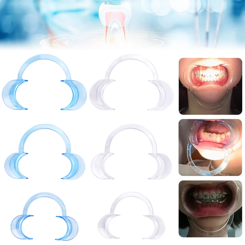 3pcs Dental C Shape Mouth Opener Intraoral Cheek Lip Retractor Mouth Gag Orthodontic Tool Mouth Spreader Lip Opener
