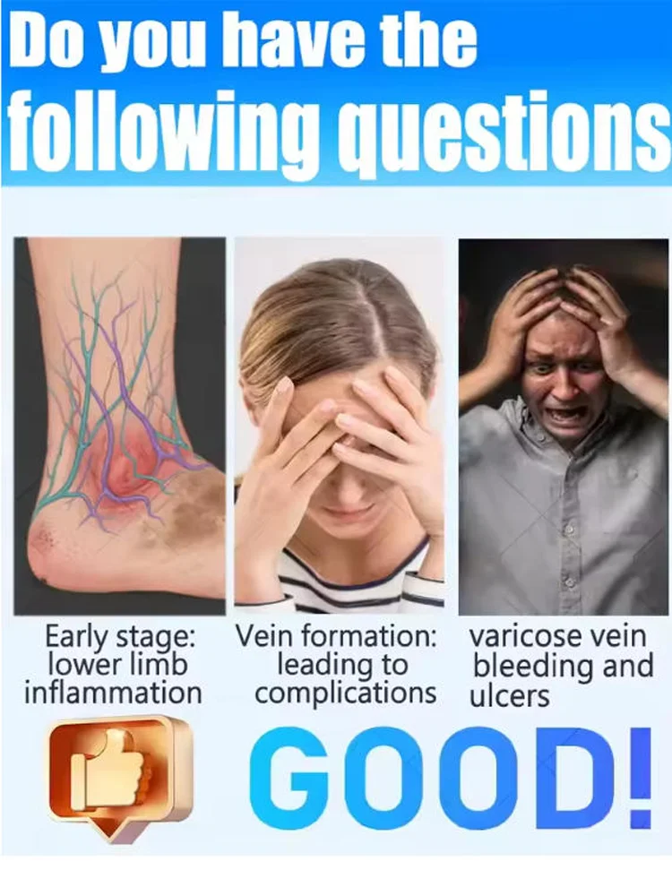 Reverse leg health in 7 days and say goodbye to varicose vein recurrence