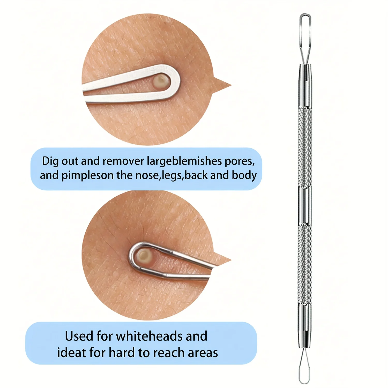 Pęseta do zaskórników na trądzik Piękno twarzy Usuń narzędzia igłowe na trądzik do pielęgnacji skóry, precyzyjny popper na pryszcze na skazy i zaskórniki