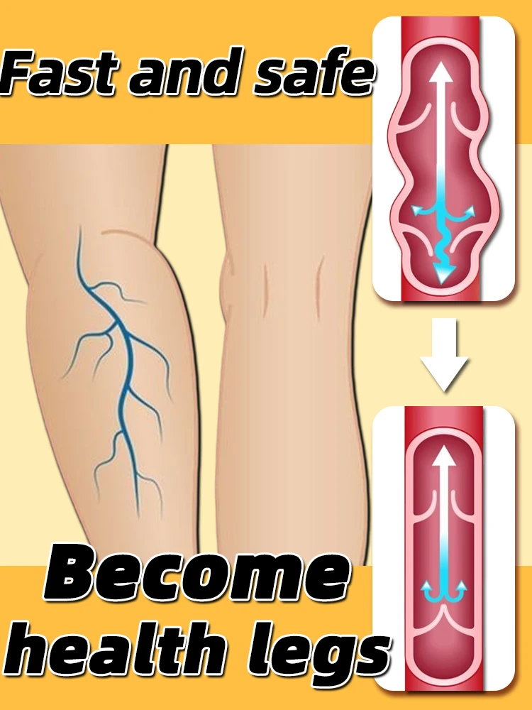 

Therapy Leg Repair Pen Relieves Leg Bulge Discomfort Improving Blood Circulation Varicose Veins Pen Skin Care Product New