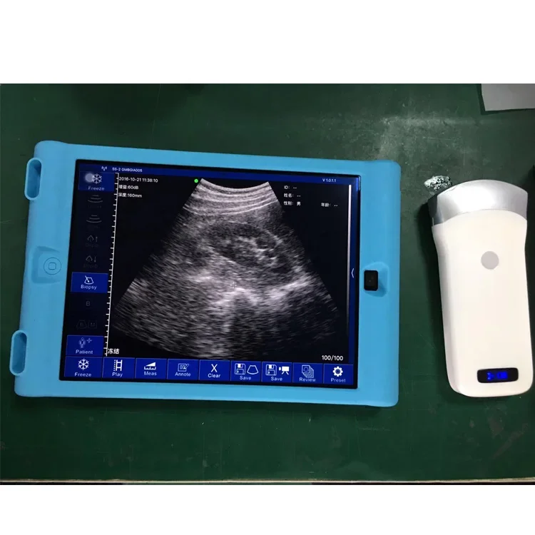 Portable B/W Ultrasound Scanner Medical Abdominal/Convex  preg nancy Ultrasound Examination Probe for Human