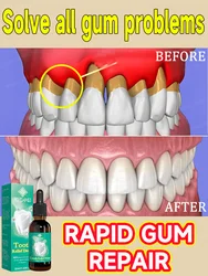 Quickly relieve toothache, repair damaged gums, and have healthy gum drops