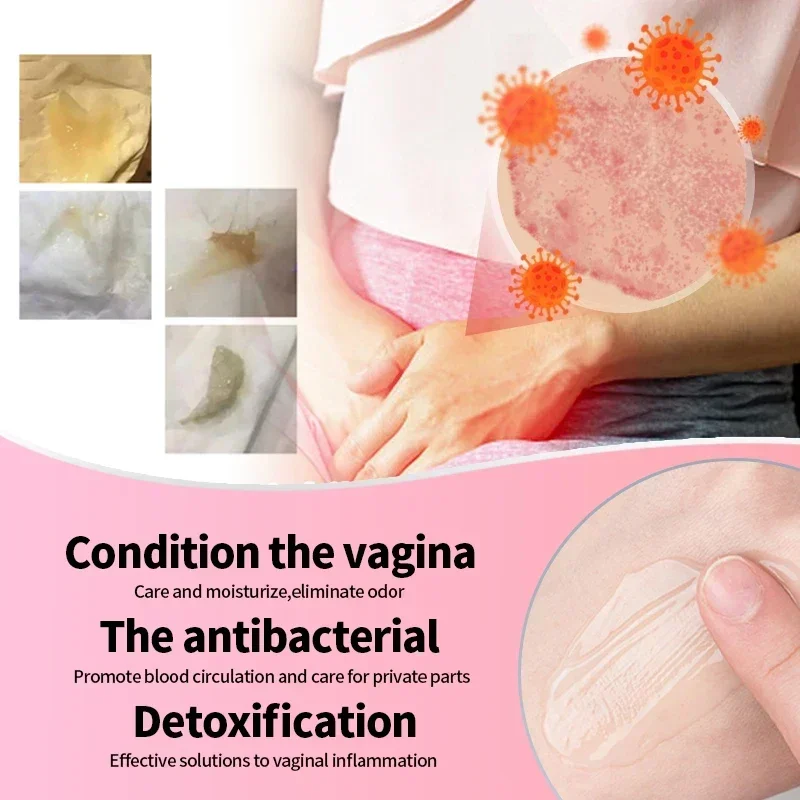 Vaginal Womb Detox Cream Vaginale Serrage Infection Women Gynecological Vaginitis Treatment Vagina Cleaner Feminine Hygiene Care