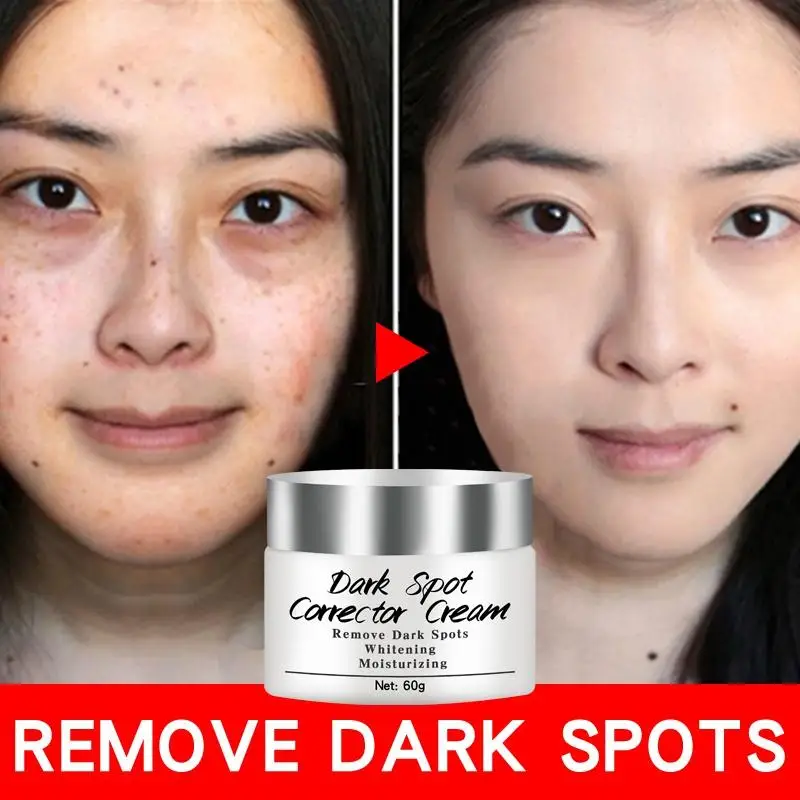 Newest Dark Spots Corrector Cream Whitening Facial Cream Repair Fade Freckles Remove Dark Spots Melanin