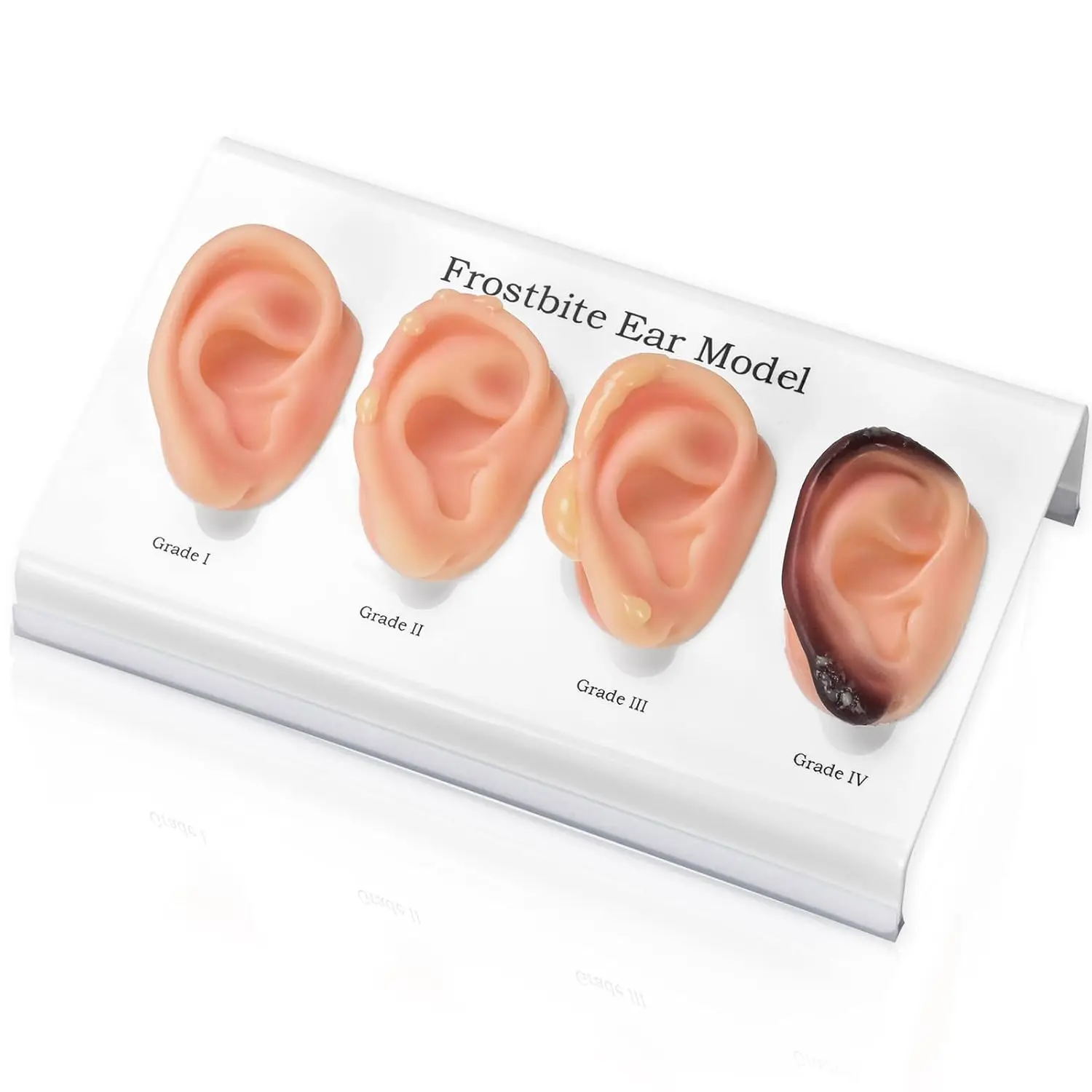 

Realistic Human Ear Frostbite Model Silicone Simulation 4 Stages Display Models for Medical Training Practice and Teaching