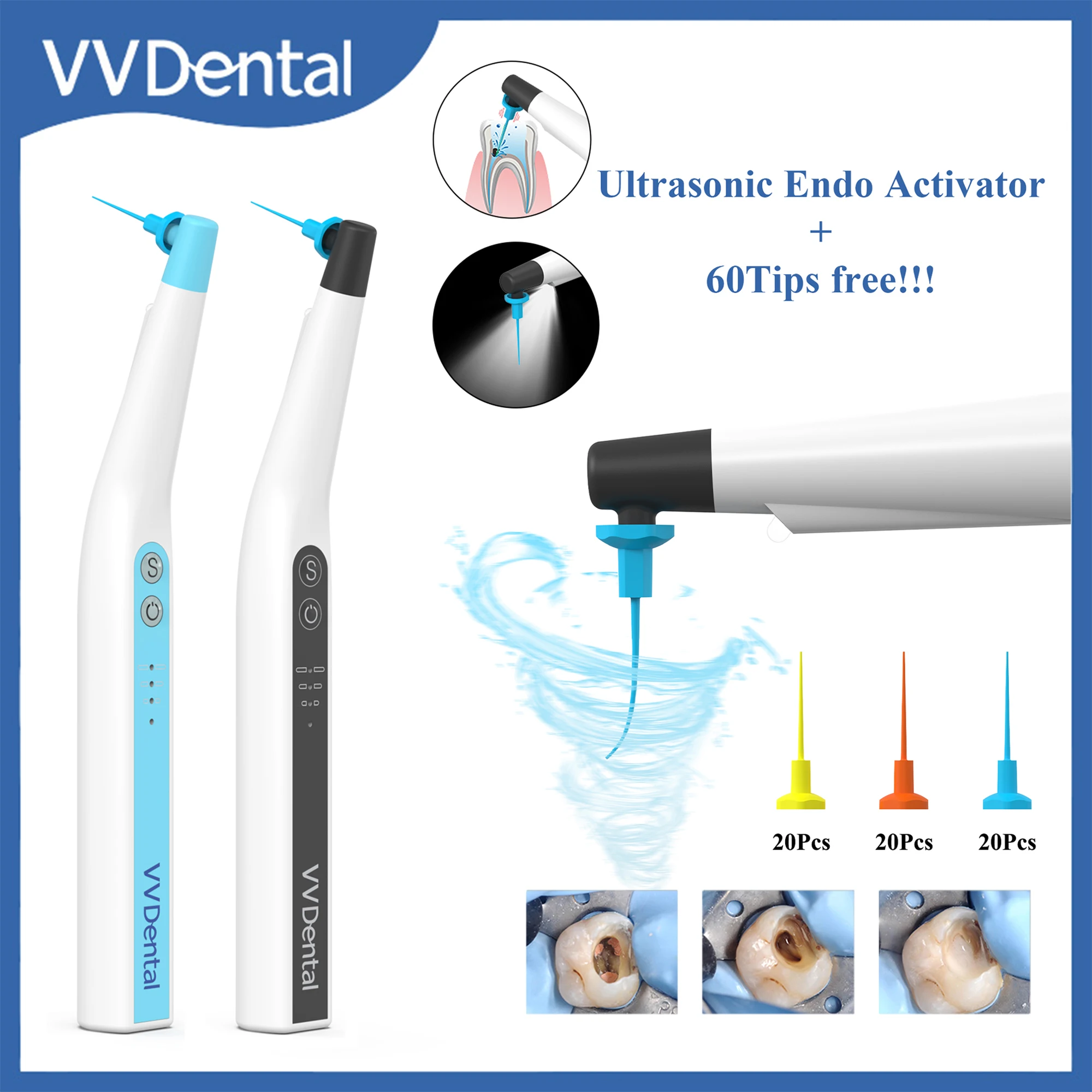 

VVDental Sonic Irrigator Tips Endo Activator With LED Light 60Pcs Endo Files For Root Canal Irrigator Endodontic Cleaning Motor