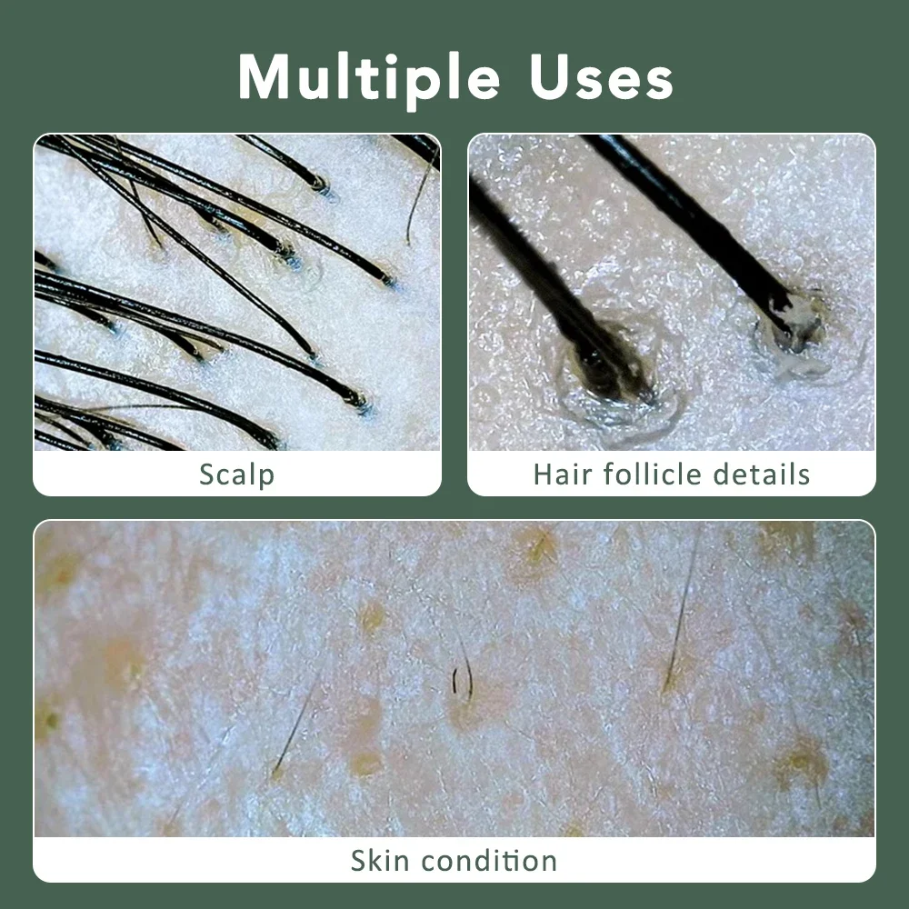 Multifunctionele Hoofdhuid Huid Haarfollikel Detector Visuele HD Huidanalysator Machine Vergrootglas Dermatoscoop Telefoon Tablet Verbinding