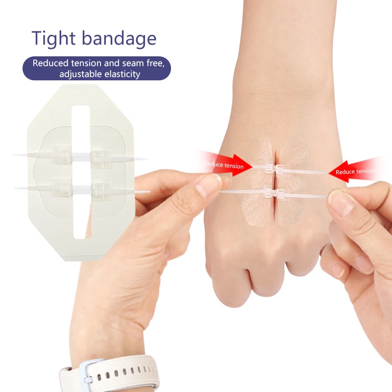 1Pc Zipper Tie Wound Closure Patch Zipper Band-Aid Wound Fast Suture Outdoor Portable Hemostatic Patch First Aid Tool