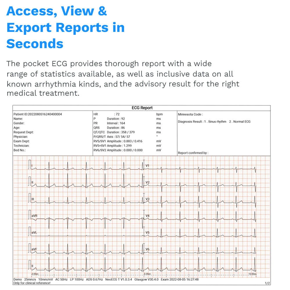 Lepu 12-Lead Pocket ECG Machine 24-hour Handheld ECG Machine Glasgow ECG Data Analysis Report Adults & Pediatrics Cardiologists