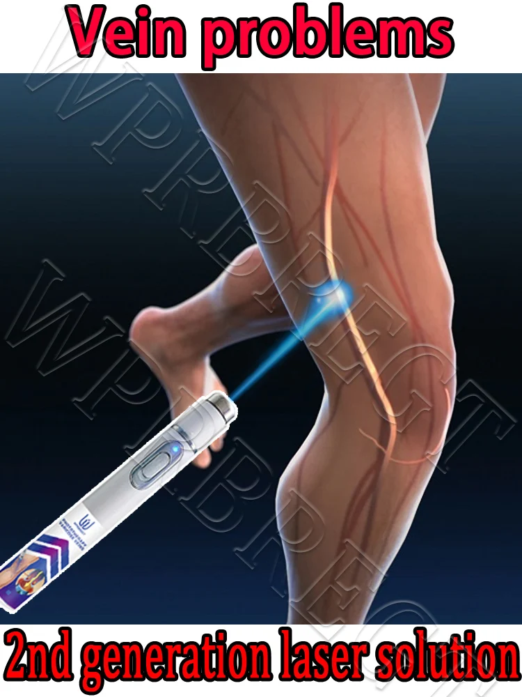 

Painless treatment of vasculitis and phlebitis, relief of spider leg pain