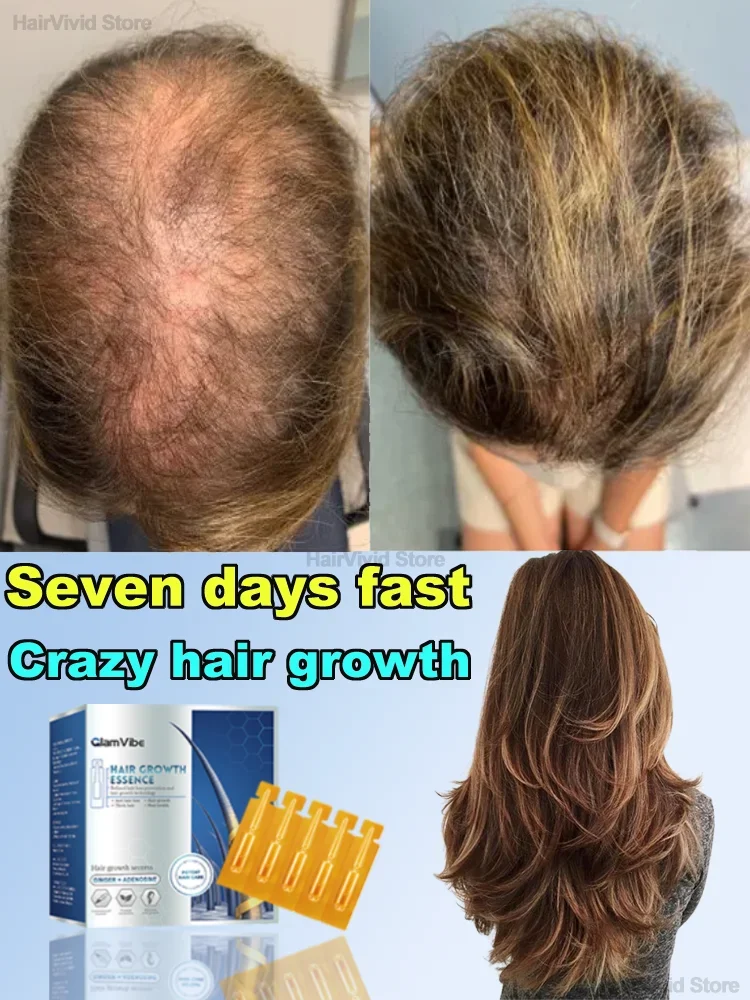 

Fixed hair,hair fix，Regeneration，Best sales in 2024 top sell！