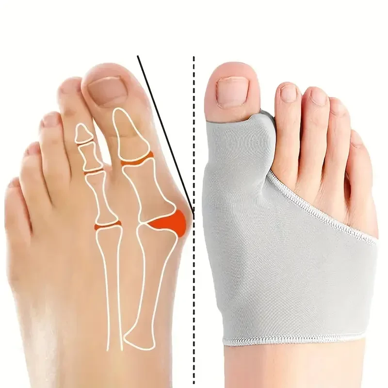 2 Stuks = 1 Paar Teen Separator Hallux Valgus Bunion Corrector Orthesen Voeten Bone Duim Richter Correctie Pedicure Sok stijltang