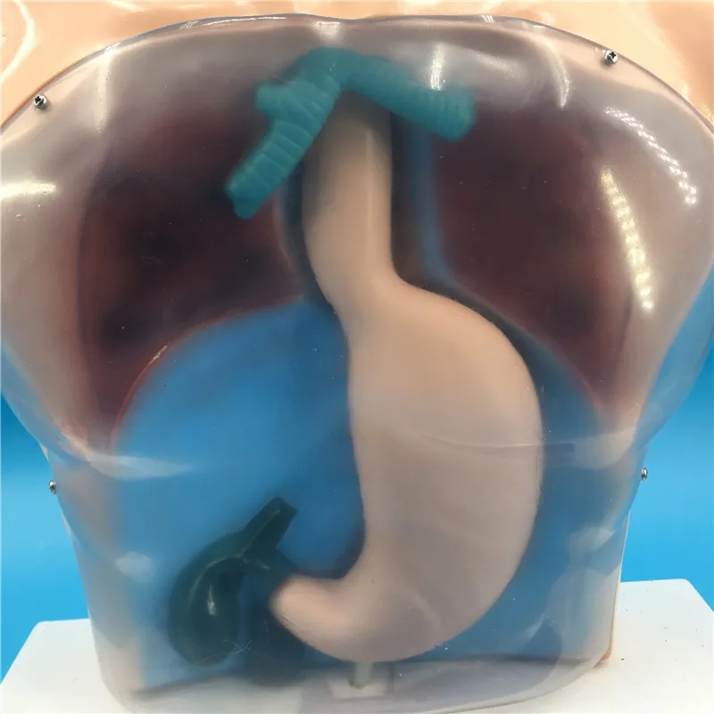 Model with Transparent Gastric Lavage Mechanism and Warning Gastric Lavage Practice Model