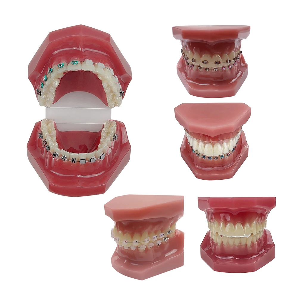 Orthodontic Teaching Model Oral Model Half Ceramic Half Metal Bracket for Dentist Doctor-patient Communication Tool