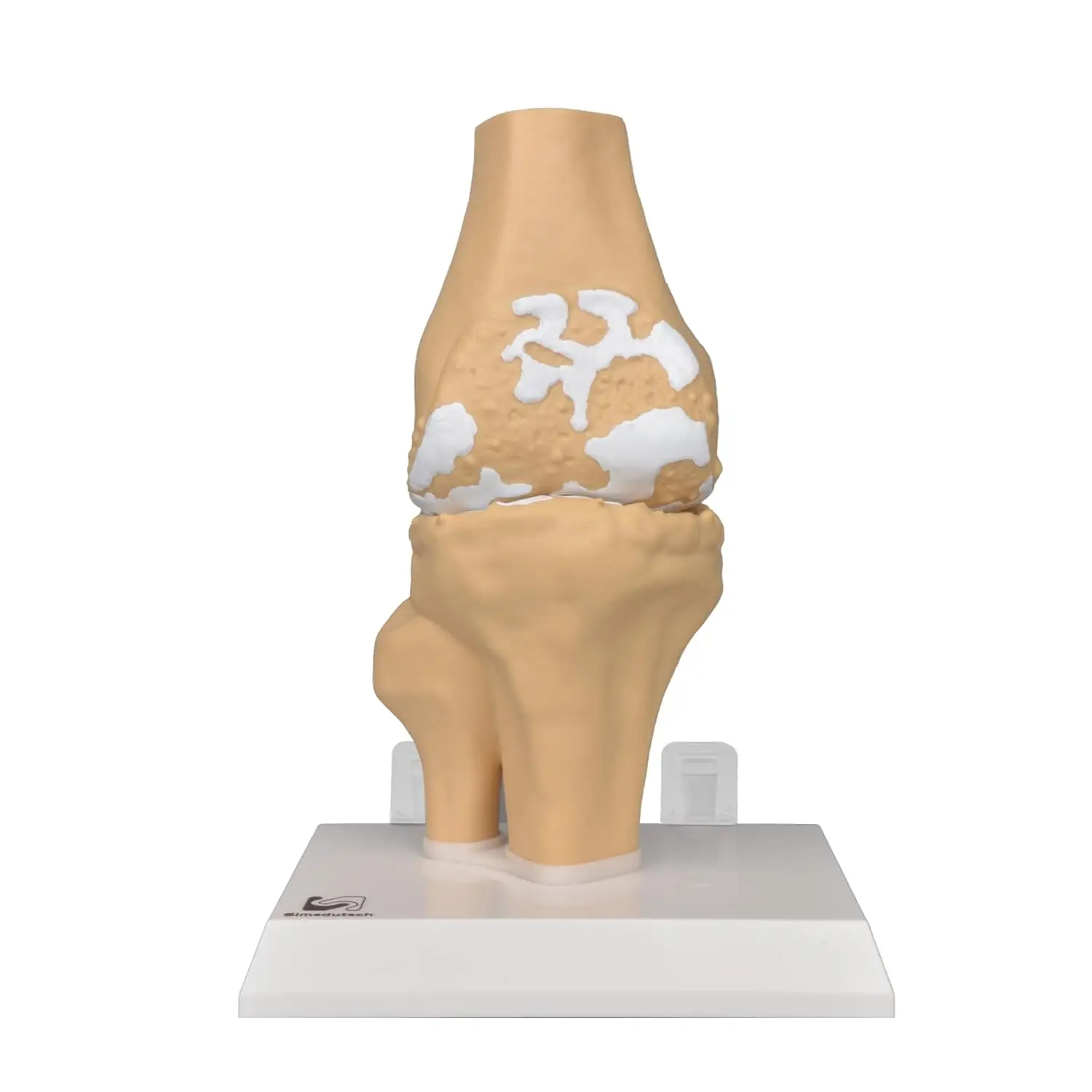 Replica Human osteoarthritis Bone Model Knee Joint Anatomic Model for Medical Teaching Demonstration Doctor's Office Classrooms