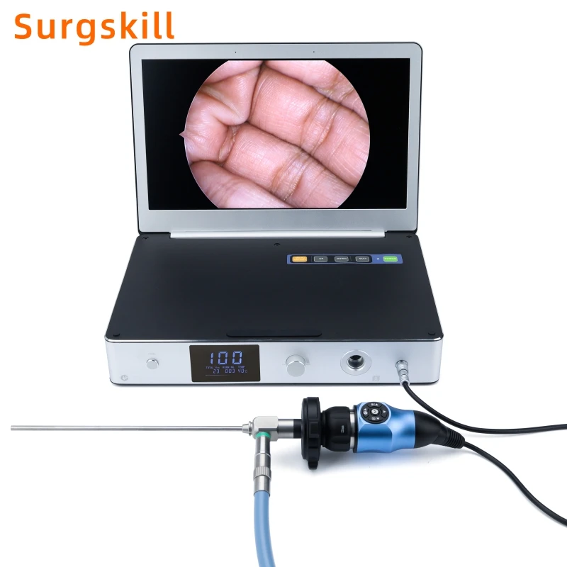 Portable Full HD 1080P Endoscope Camera with 30W LED Light Source and 11.6 Inch Monitor