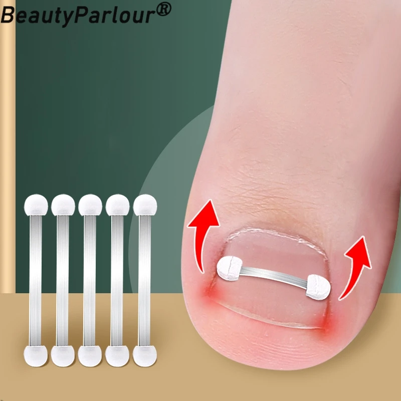 Ingrown Toenail Corrector Tools Pedicure Recover Embed Toe Nail Treatment Professional Ingrown Toenail Correction Foot Care Tool