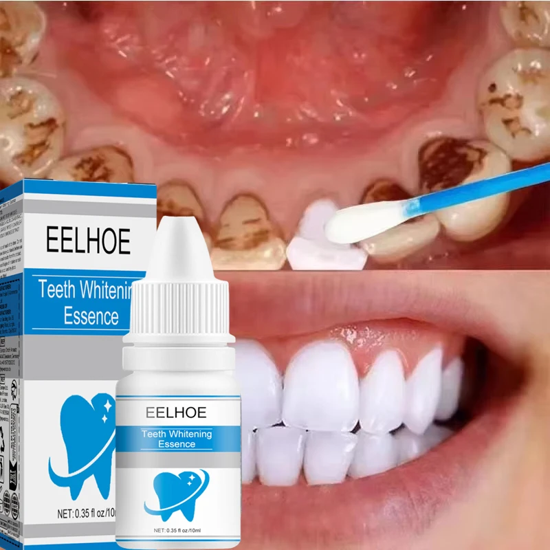Toothpaste Dental Calculus Remover Whitening Removal Bad Breath Teeth Brightening Alleviate Periodontitis Dental Cleansing Care