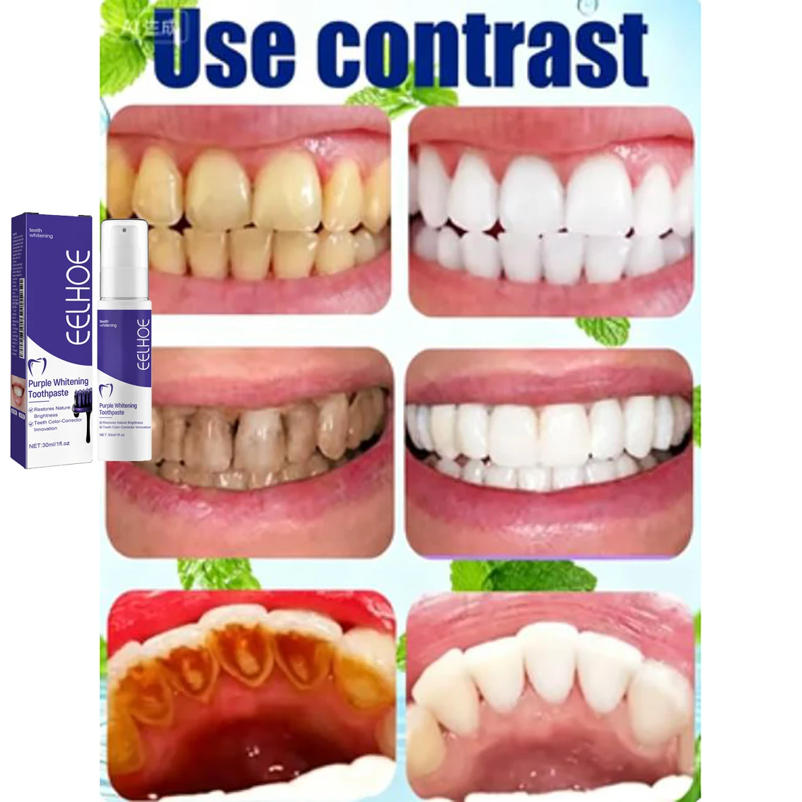 Tandenreiniging Whitening Tand - Teeth Whitening Korea recensie en prijs