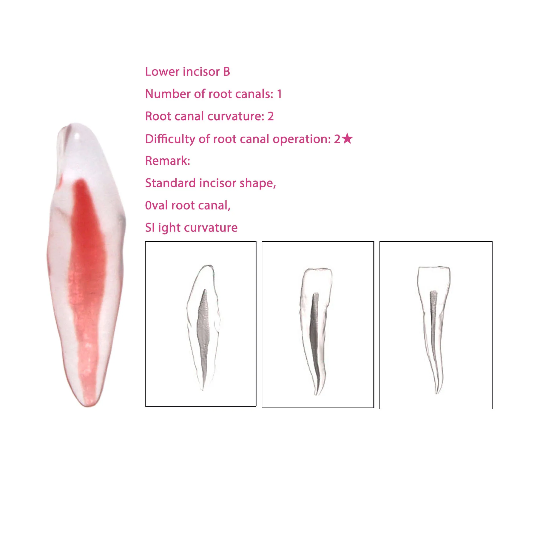 

Dental Root Canal Model Practice Model 3D Lower Incisor B Root Canal Therapy Resin Model Endodontics RTC