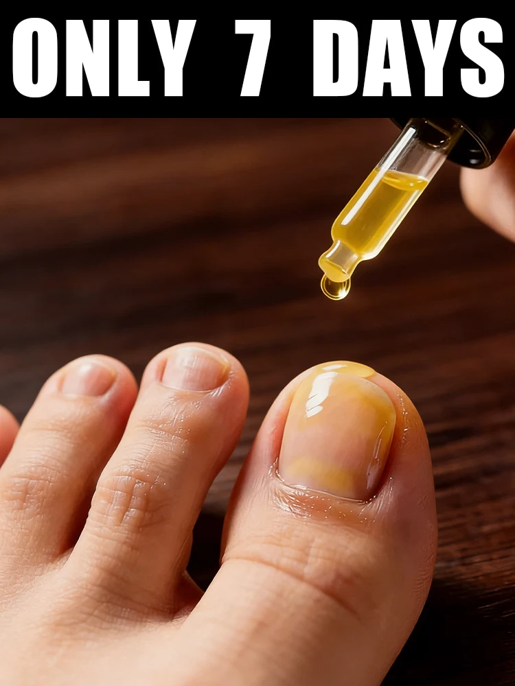 

2026 Limited Offer! Free Shipping! Tea Tree Nail Solution 10ml