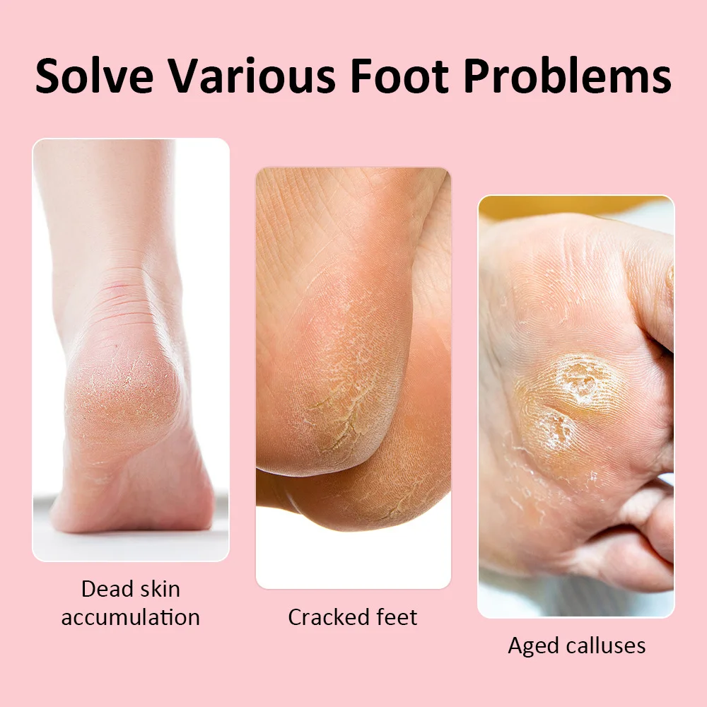 Elektrische Fußpflege Datei Bein Heels Entfernen Abgestorbene Haut Pediküre Werkzeug Set Füße Sauber Pflege Fuß Grinder Schleifpapier Nagelhaut Grinder