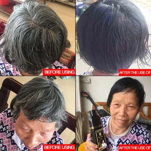 DIY Haarfarbe Shampoo, 3 in 1, Schwarz, Dach, Weiß, Flora, Fast, Dye, Creme, Styling, Weiß, 500 ml 12 Hauptverkäufe Shampoo an färbende Haare - №10