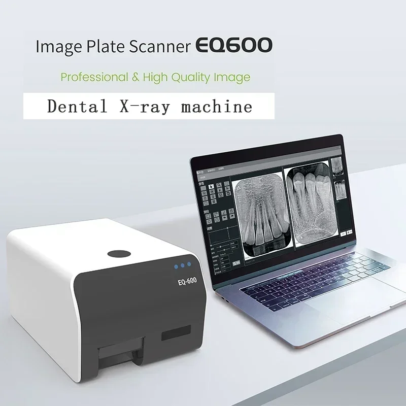 VRN EQ-60 Offers Extraordinarily Transparent Gentle Scans Faster Picture Rendering, More Trustworthy 16-Bit Values for Dentistry