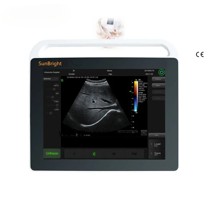 

Veterinary ultrasound machine Black and white animal ultrasound equipment Touch screen