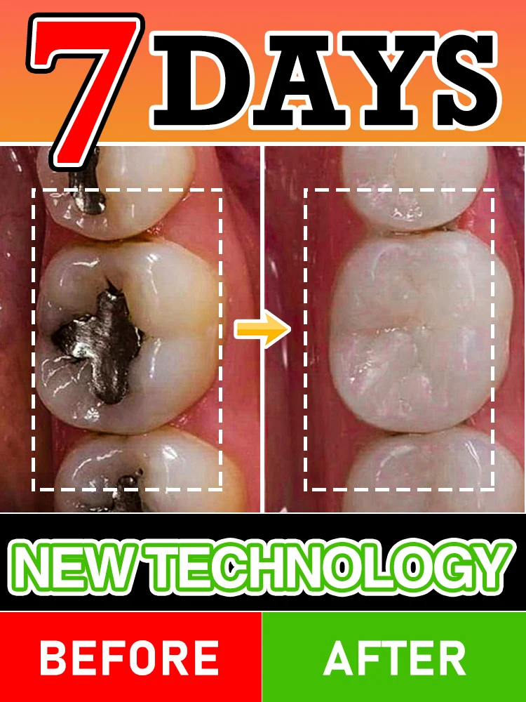 

Cavity Rescue Dental Mousse - Rebuilding Tooth Structure - Night Use Recommended