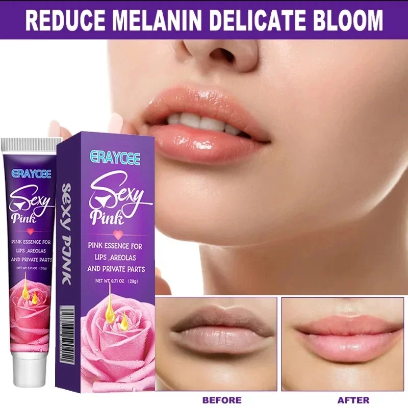 Whitening Cream Private Parts Underarm Bleaching Gel Whiten Lips Butt Knee Brighten Inner Thigh Intimate Parts Dark Remove Care