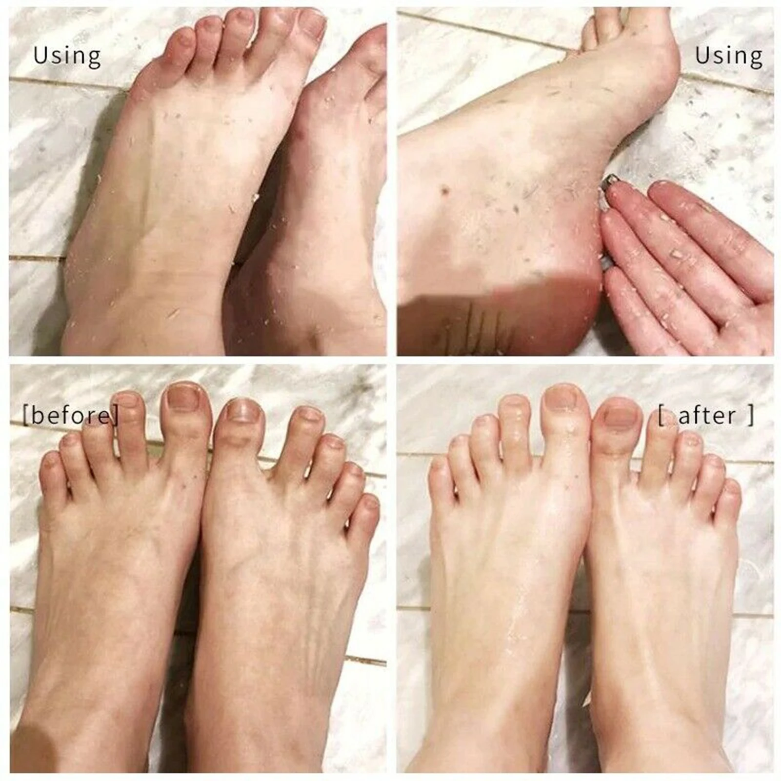 100ml Foot Peeling Spray Elbow Exfoliating Essence Pedicure Cosmetics Non-Irritating Moisturizing Clean & Brighten Skin