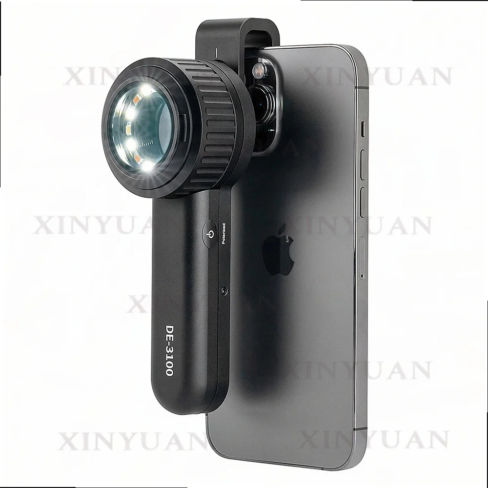 Handheld Dermoscope 10X Magnification Polarized 365nm UV Light Mode for Fungal Skin Lesion Examination