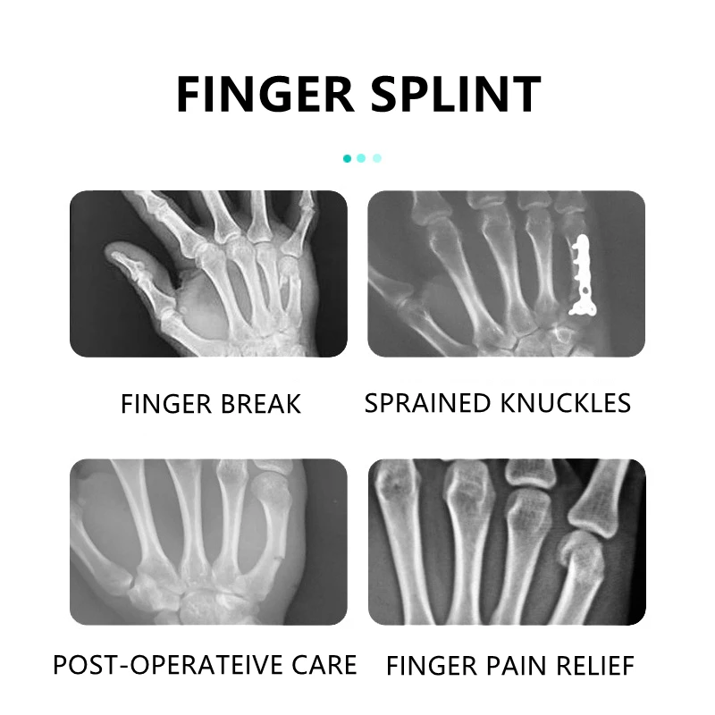 1pcs Finger Splint Brace 4th or 5th Finger Immobilizer Broken Fingers Support Trigger Finger Support for Arthritis Tendonitis