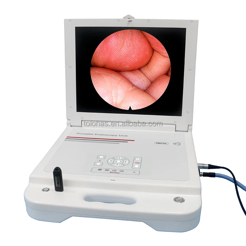 

LHGW611 Portable Medical Monitor Led Light Source ENT CCD Endoscope Camera Portable Endoscopy Unit