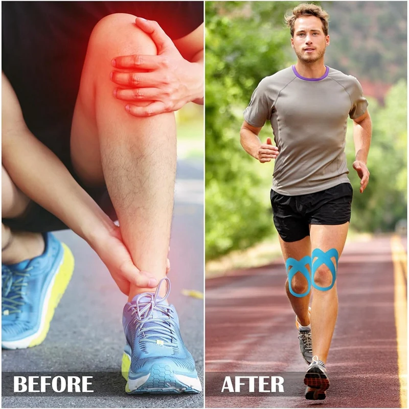 Knee Kinesiology Tapes, Pre-Cut Knee Tapes, Breathable Sticky Sports Tapes Waterproof, Ankle Gym Fitness Running Tennis